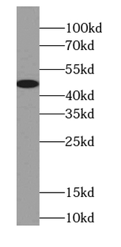 CPA3 Rabbit Polyclonal Antibody