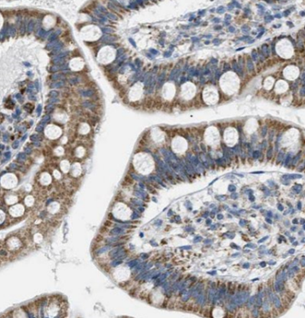 CPA3 Rabbit Polyclonal Antibody