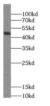 CSNK1D Antibody