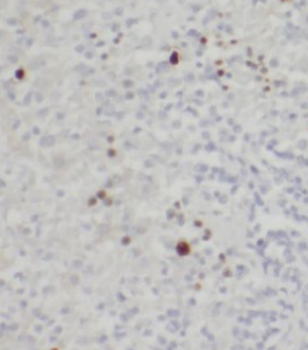 CD40LG Antibody
