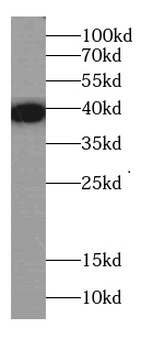 NCR2 Rabbit Polyclonal Antibody