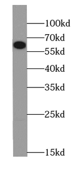 CDC7 Rabbit Polyclonal Antibody