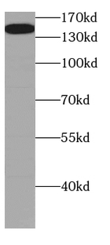 CGNL1 Rabbit Polyclonal Antibody