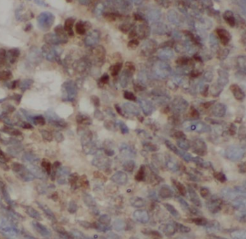 CGNL1 Rabbit Polyclonal Antibody