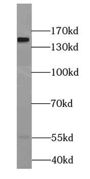 CHAF1A Rabbit Polyclonal Antibody