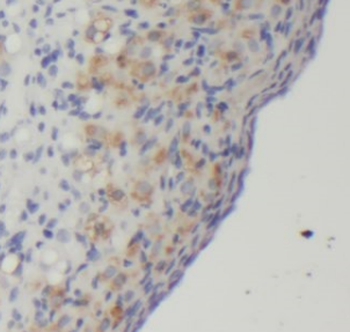 CHAF1A Rabbit Polyclonal Antibody