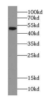 CHKA Specific Rabbit Polyclonal Antibody