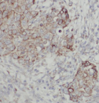 CHKA Specific Rabbit Polyclonal Antibody