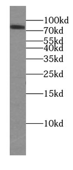 CHPF N Terminal Rabbit Polyclonal Antibody