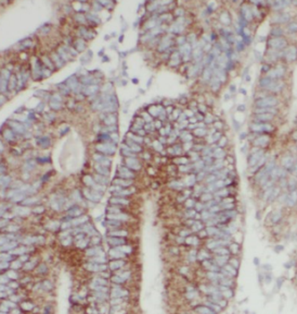 CHPF N Terminal Rabbit Polyclonal Antibody