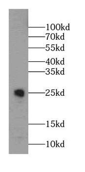 CHST13 Specific Rabbit Polyclonal Antibody