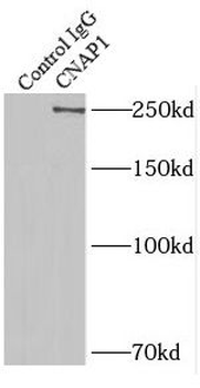NCAPD2 Rabbit Polyclonal Antibody