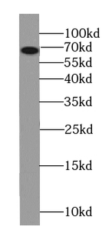 COG8 Rabbit Polyclonal Antibody