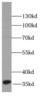 C1GALT1C1 Rabbit Polyclonal Antibody