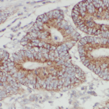 C1GALT1C1 Rabbit Polyclonal Antibody