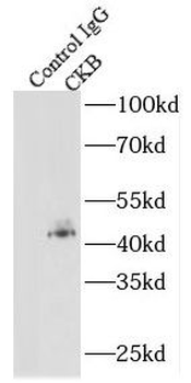 CKB Rabbit Polyclonal Antibody