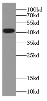 CKB Rabbit Polyclonal Antibody