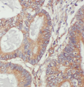 CKB Rabbit Polyclonal Antibody