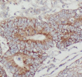 CKB Specific Rabbit Polyclonal Antibody