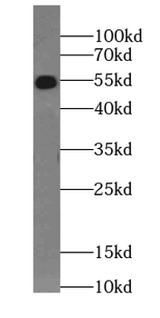 SS18L1 Antibody
