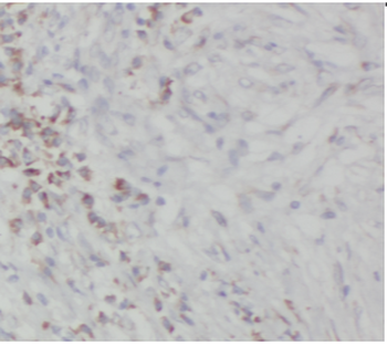 SS18L1 Antibody