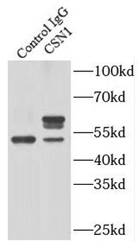 GPS1 Rabbit Polyclonal Antibody