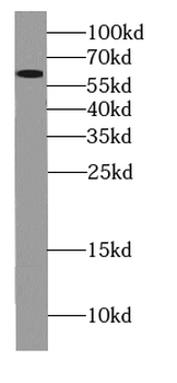 GPS1 Rabbit Polyclonal Antibody