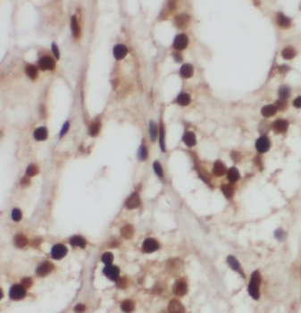 GPS1 Rabbit Polyclonal Antibody