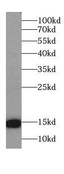 CST2 Specific Rabbit Polyclonal Antibody