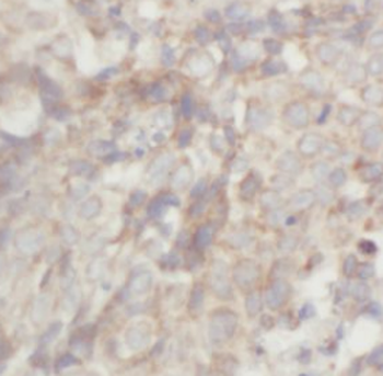 ACKR3 Antibody