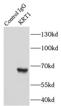 KRT1 specific Rabbit Polyclonal Antibody