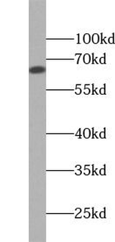 KRT1 specific Rabbit Polyclonal Antibody