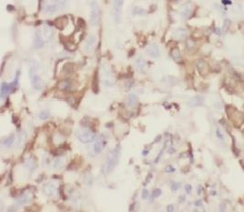 KRT1 specific Rabbit Polyclonal Antibody