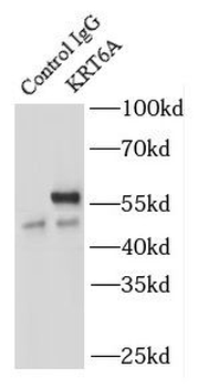 KRT6A Antibody