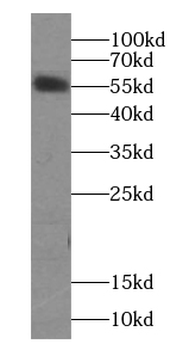 KRT6A Antibody