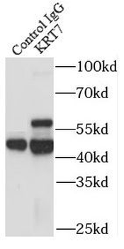 KRT7 specific Rabbit Polyclonal Antibody
