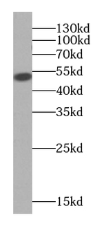 KRT7 specific Rabbit Polyclonal Antibody