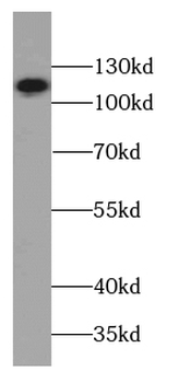 SPECC1 Antibody