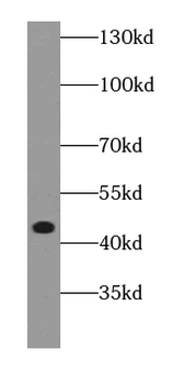 DAPK2 Specific Rabbit Polyclonal Antibody