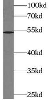 NR0B1 Rabbit Polyclonal Antibody