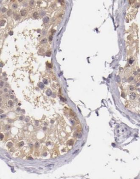 NR0B1 Rabbit Polyclonal Antibody