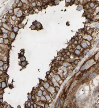 DDX4 Rabbit Polyclonal Antibody