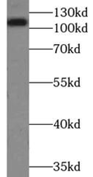 DSC2 Mouse Monoclonal Antibody