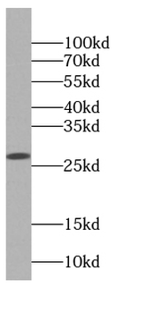 DGUOK Rabbit Polyclonal Antibody