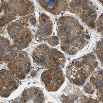 DGUOK Rabbit Polyclonal Antibody