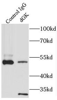 DGUOK Rabbit Polyclonal Antibody