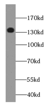 DGKK Specific Rabbit Polyclonal Antibody