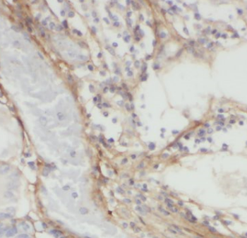DOCK1 Antibody