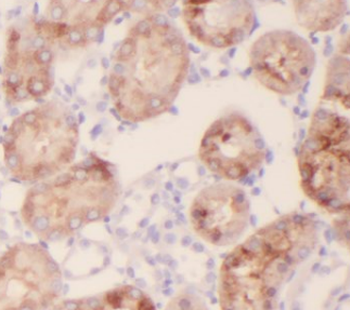FIZ1 Antibody