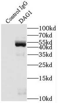 DAG1 Rabbit Polyclonal Antibody